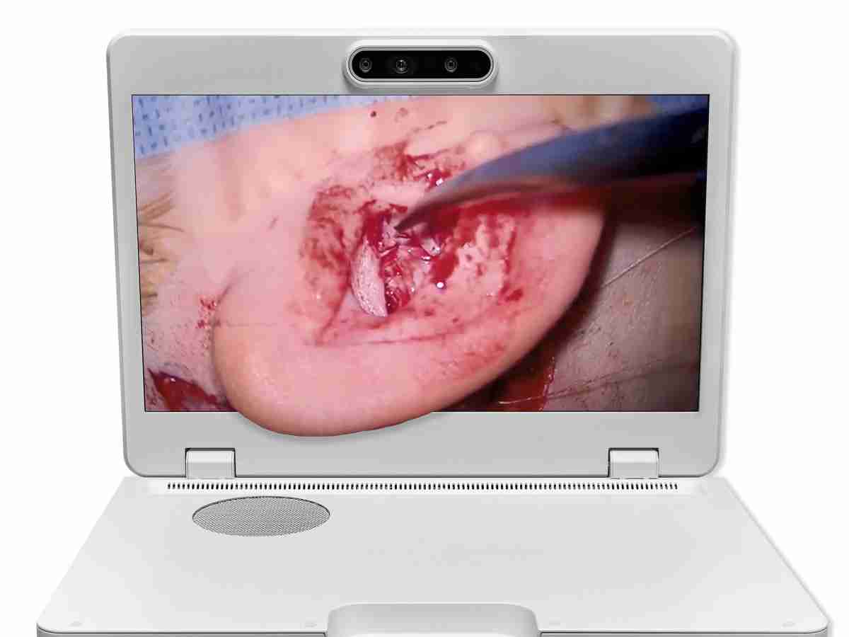 达擎之＂Heads-up 3D显微手术显示系统＂，，，，整合4K裸眼3D显示及眼球追踪系统，，，具备快速追踪人眼移动位置功能，，，减轻医师长时间维持固定姿势的负担，，，让医师能有更宽广清晰的3D立体视野及更舒适的姿势来执行手术。。